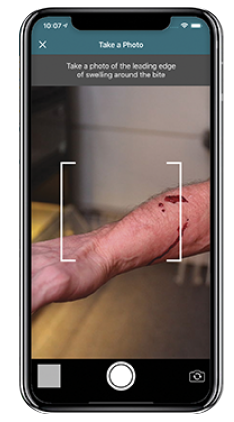Image of phones showing the location of hospitals stocking CroFab and the prompt to photo the leading edge of swelling from the SnakeBite911 App
